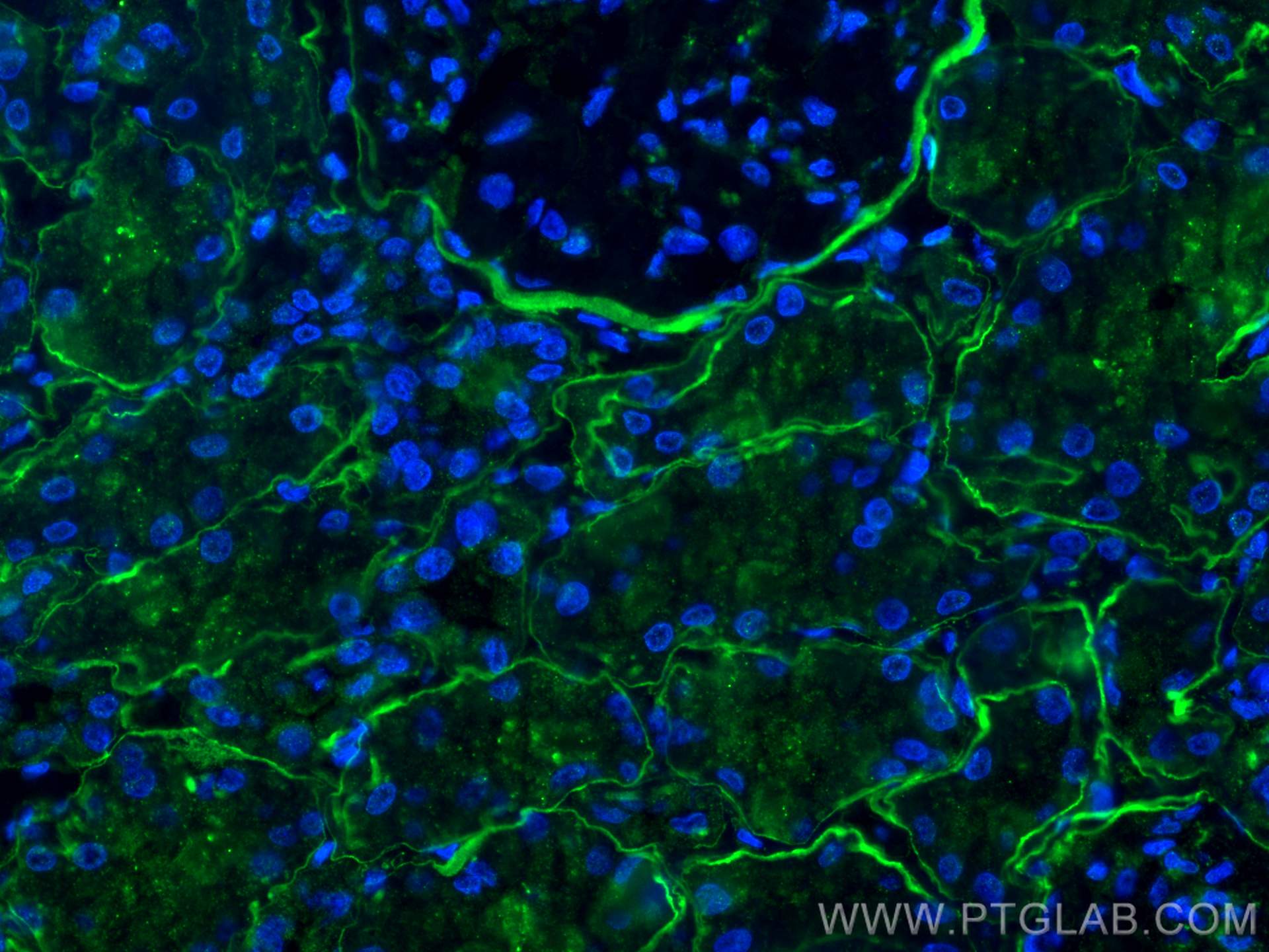 IF Staining of human kidney using 55131-1-AP