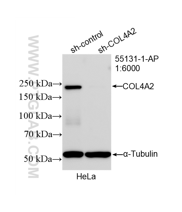 WB analysis of HeLa using 55131-1-AP (same clone as 55131-1-PBS) WB analysis of HeLa using 55131-1-AP (same clone as 55131-1-PBS)