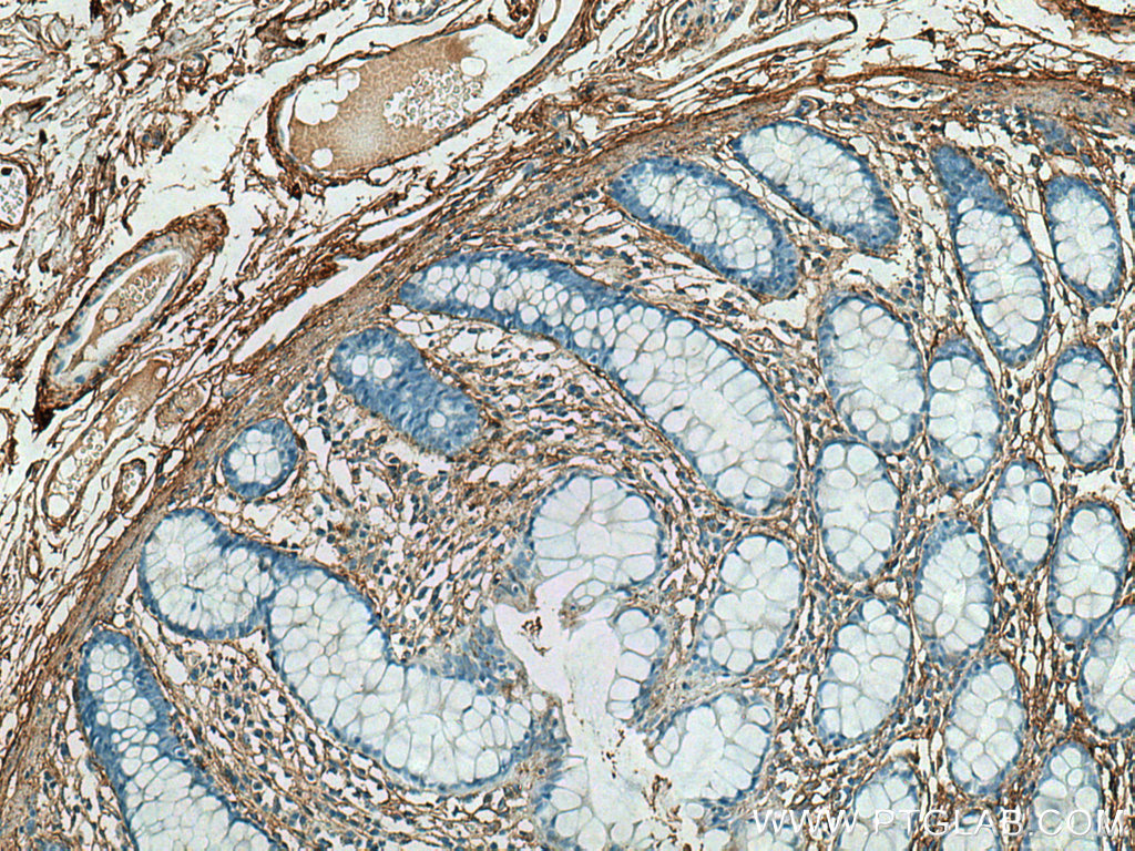 IHC staining of human colon using 28382-1-AP