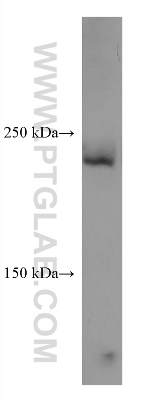 Collagen Type V