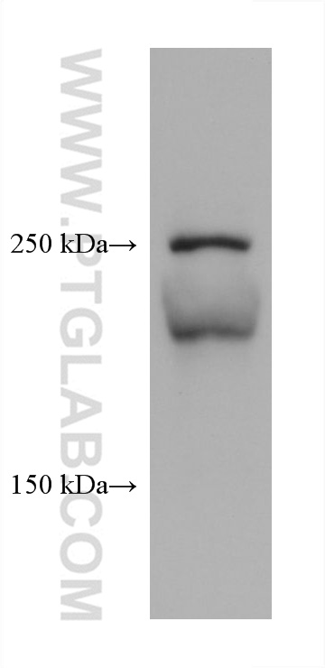 WB analysis using 67604-1-Ig
