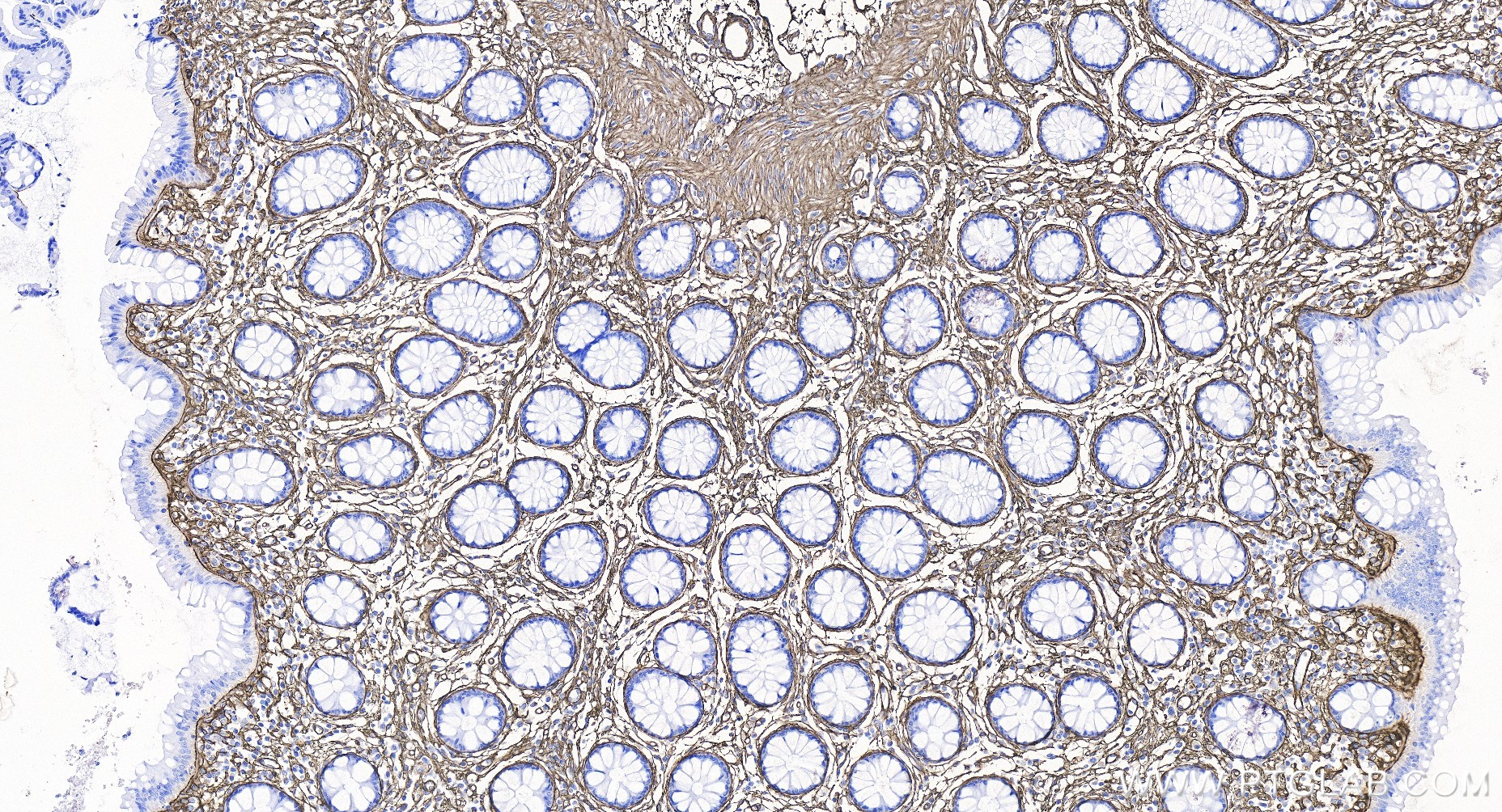 IHC staining of human colon using 85704-1-RR