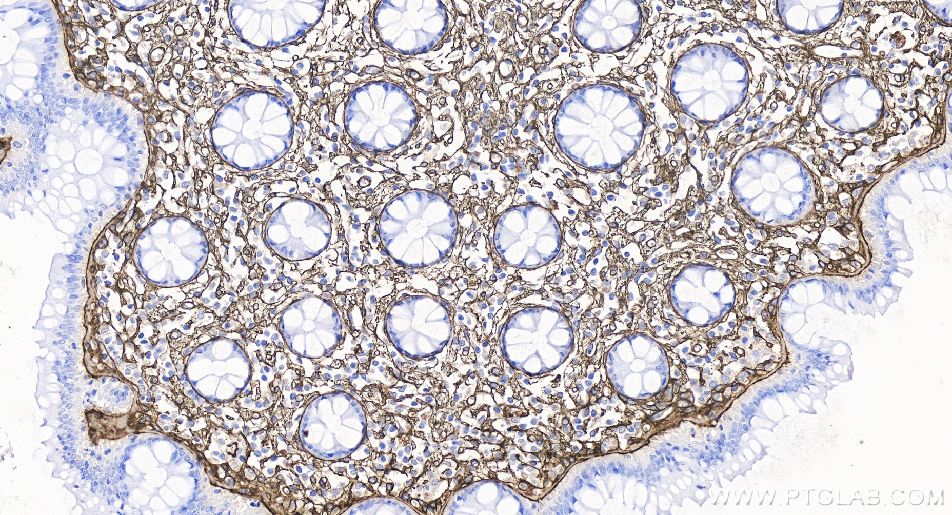 IHC staining of human colon using 85704-1-RR