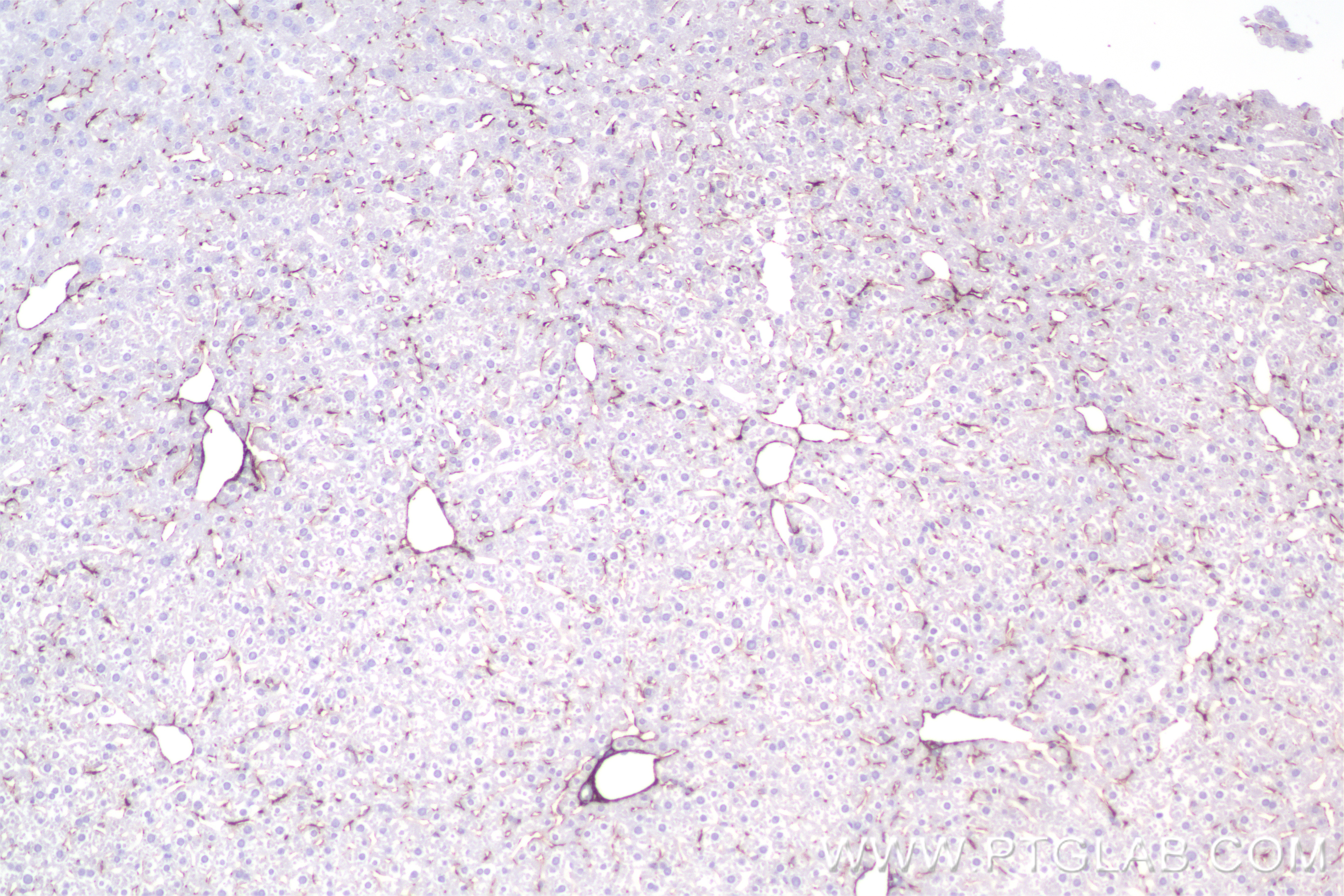 IHC staining of mouse liver using 85704-1-RR (same clone as 85704-1-PBS)