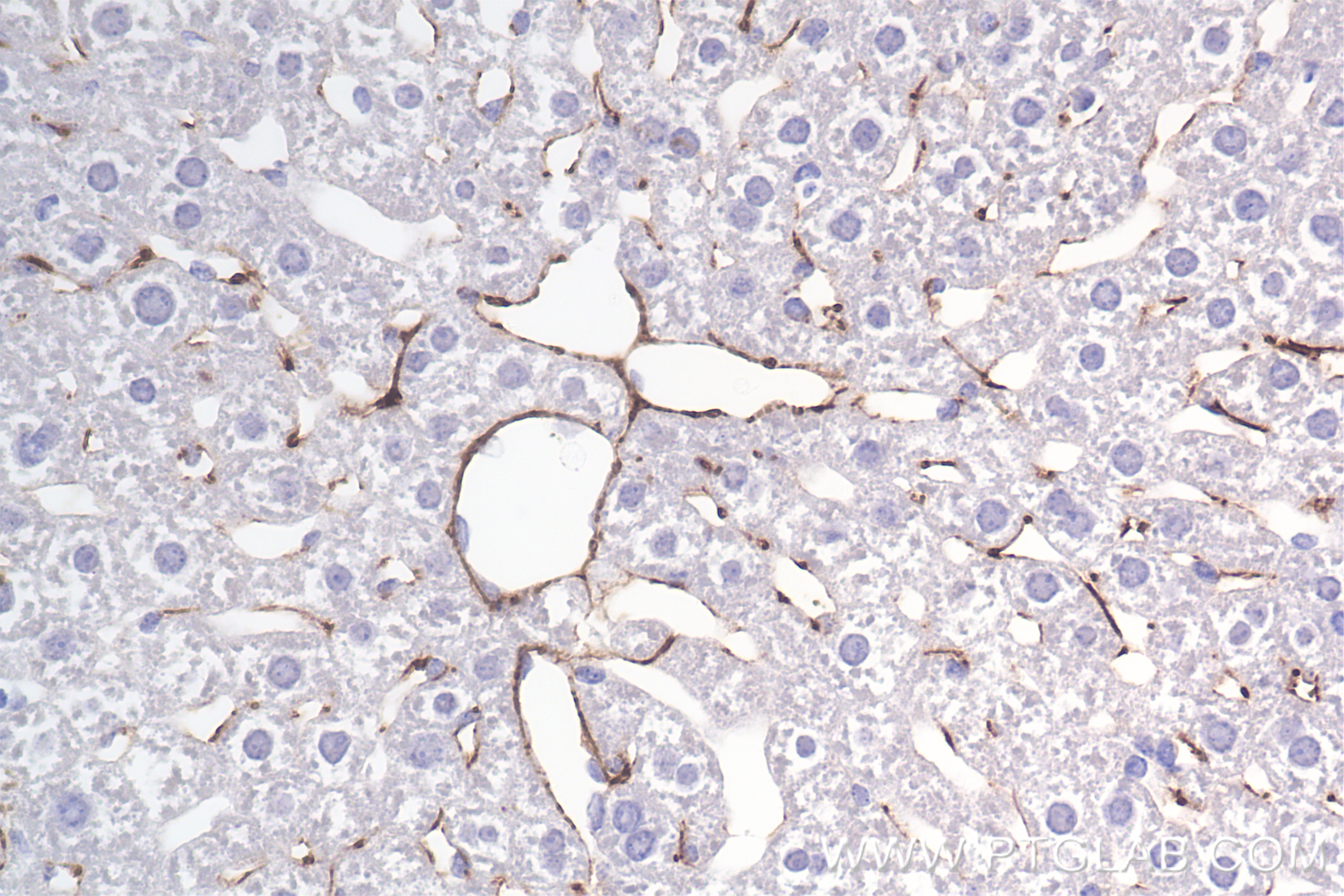 IHC staining of mouse liver using 85704-1-RR (same clone as 85704-1-PBS)