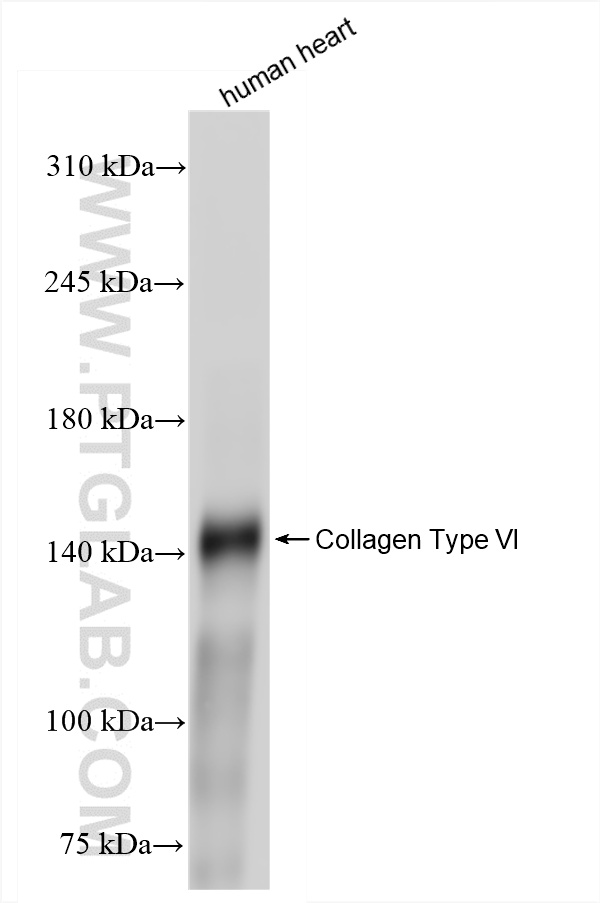 WB analysis of human heart using 85704-1-RR (same clone as 85704-1-PBS)
