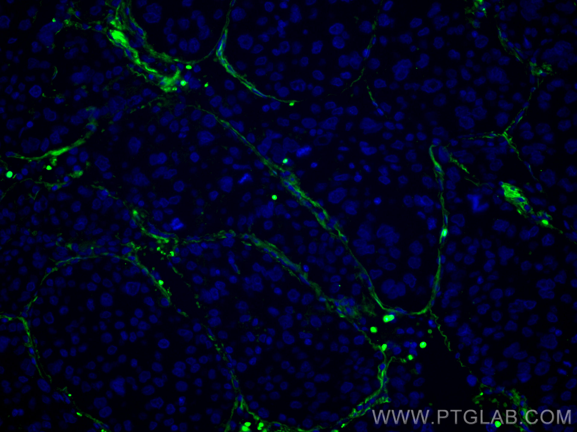 Collagen Type VI 