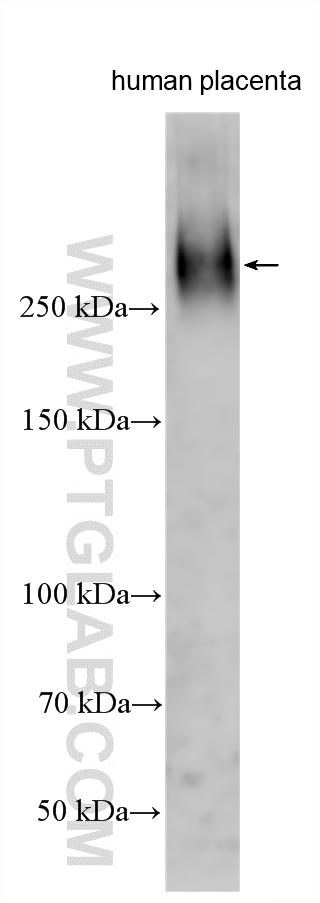 WB analysis using 31056-1-AP WB analysis using 31056-1-AP