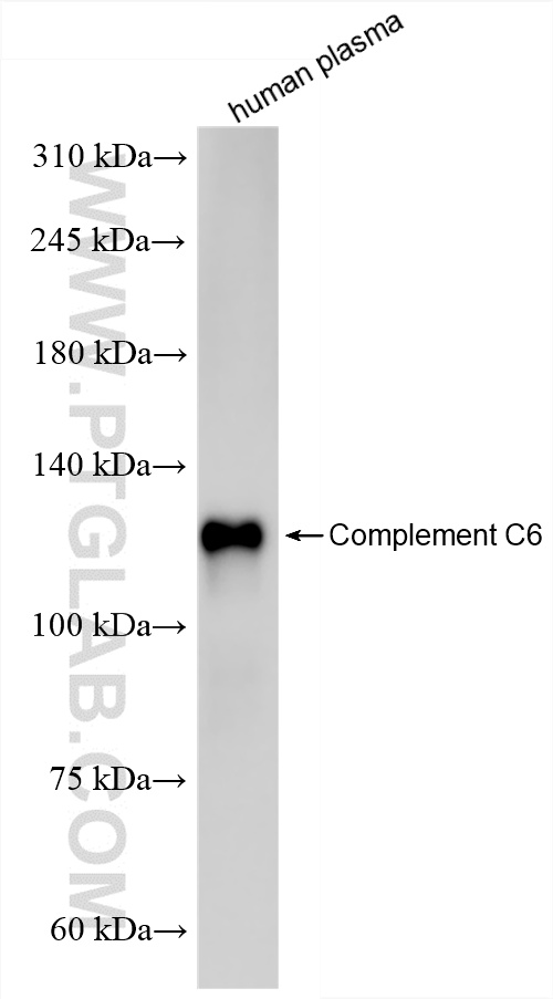 WB analysis of human plasma using 86286-3-RR