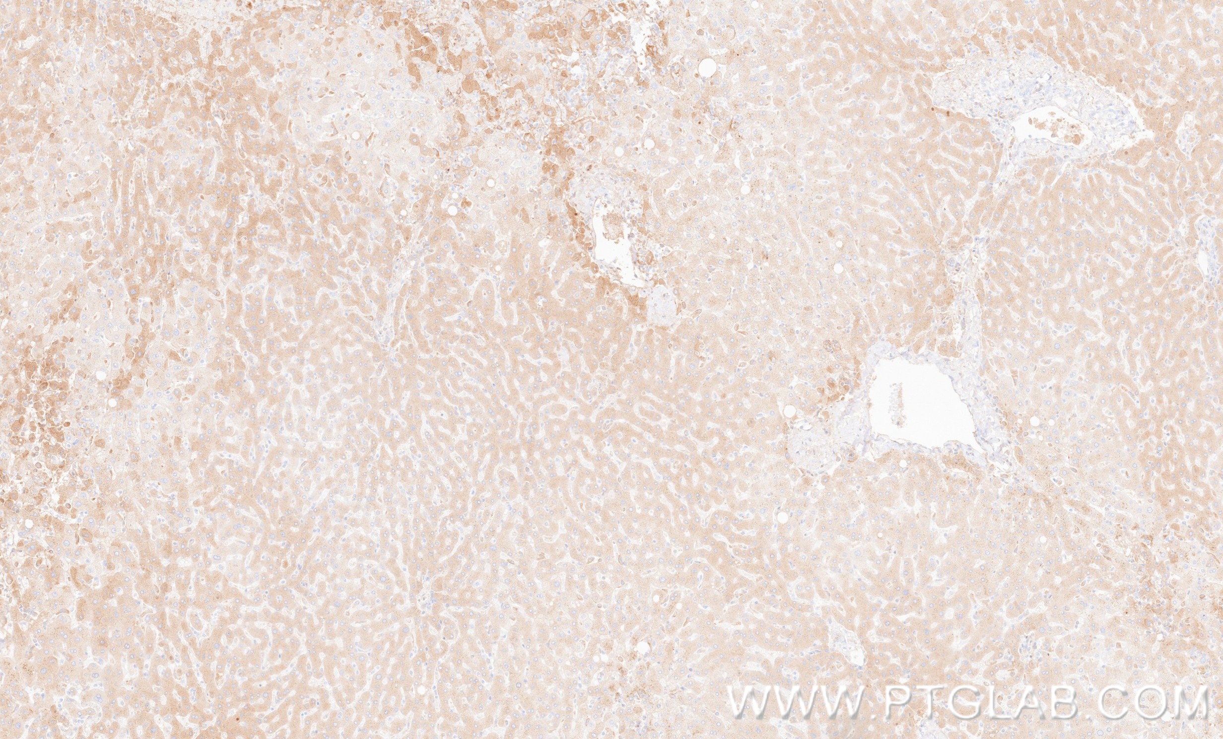 IHC staining of human liver using 87109-1-RR IHC staining of human liver using 87109-1-RR