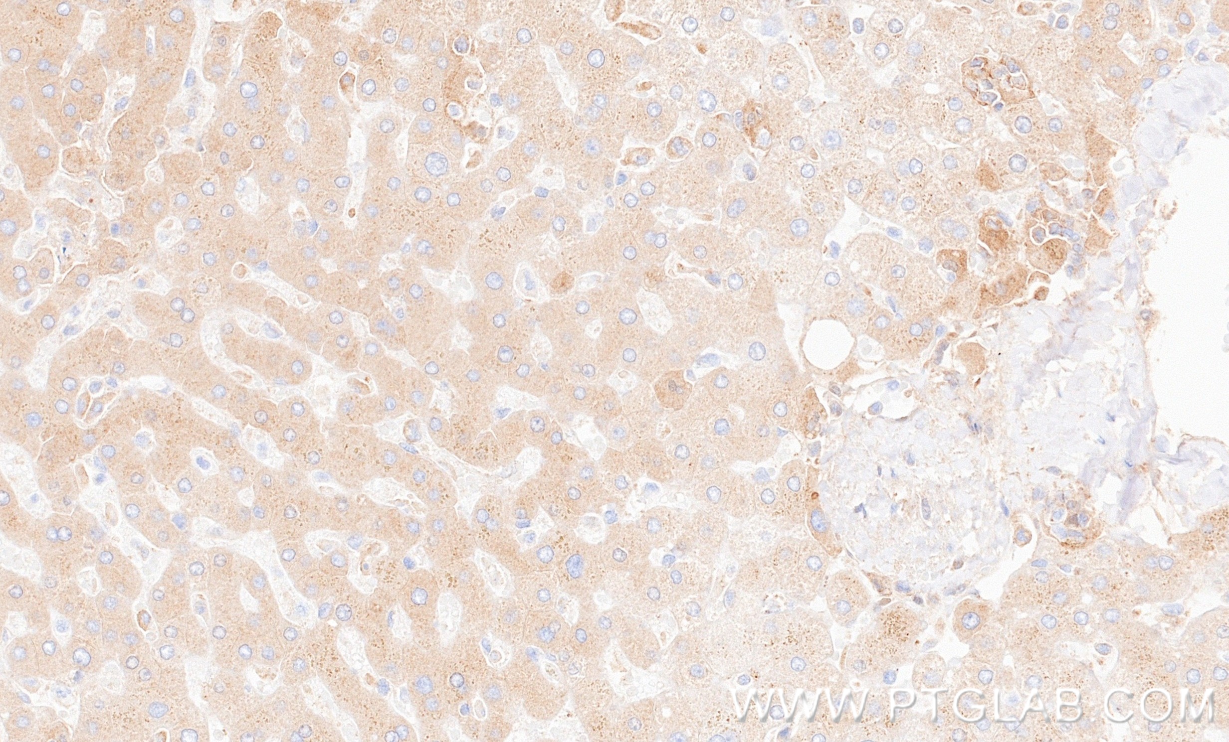 IHC staining of human liver using 87109-1-RR IHC staining of human liver using 87109-1-RR