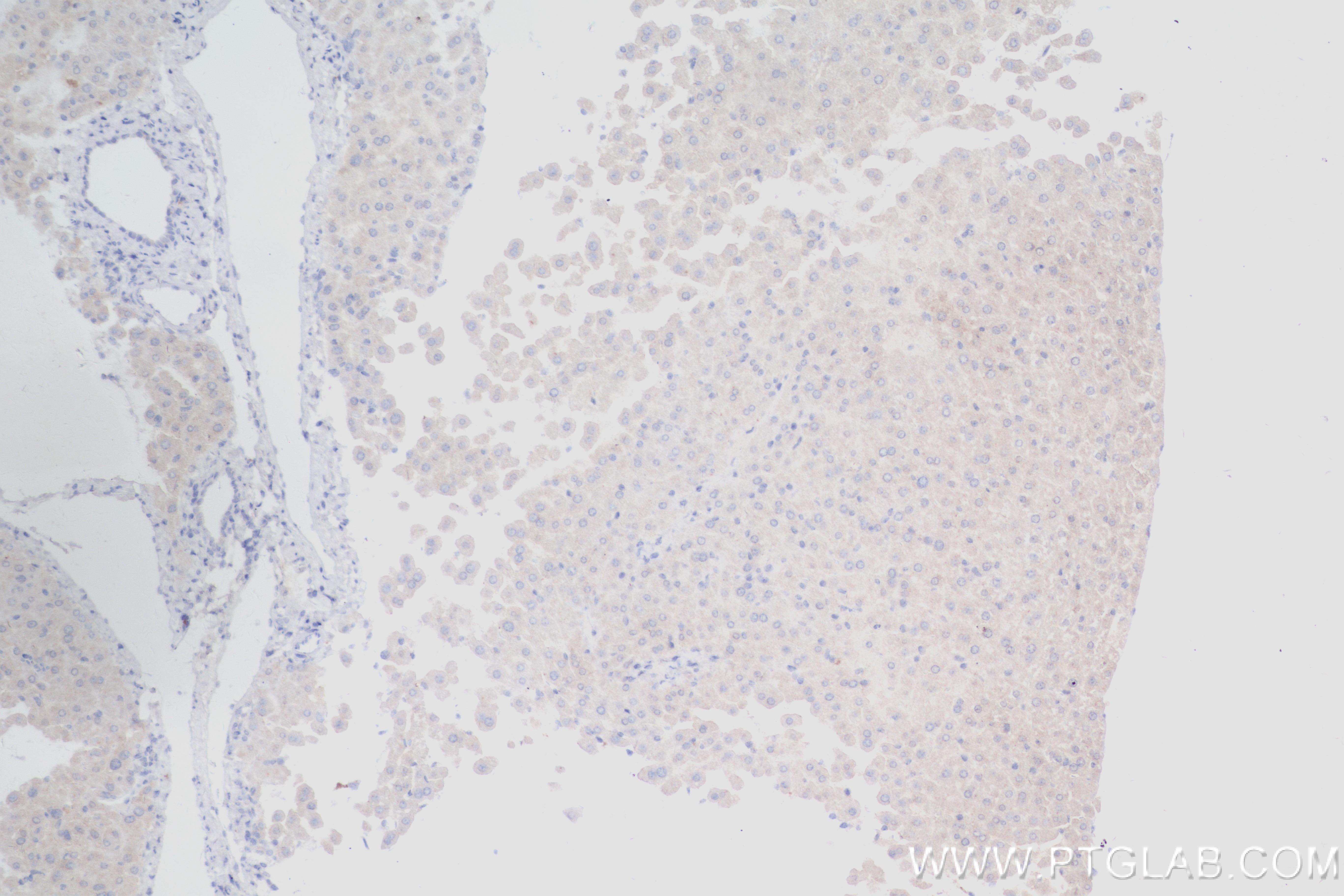 IHC staining of mouse liver using 84101-5-RR
