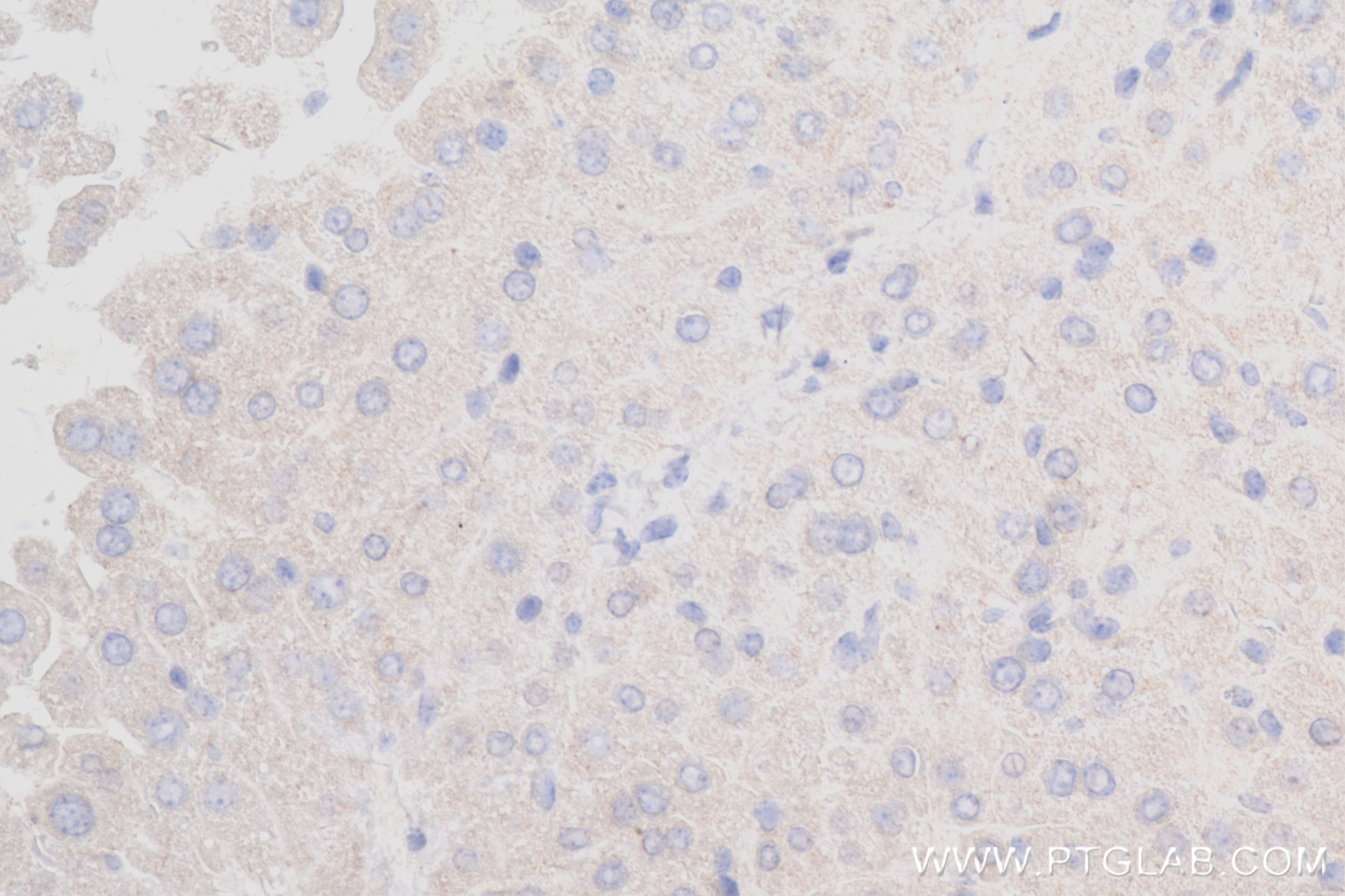 IHC staining of mouse liver using 84101-5-RR