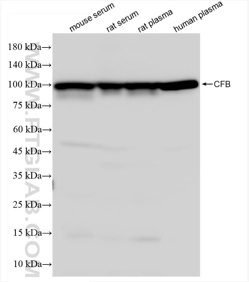 WB analysis using 84101-5-RR