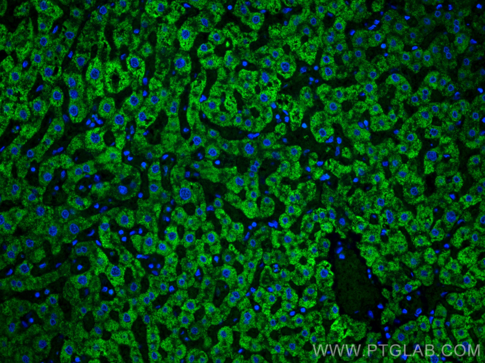 IF Staining of human liver using CL488-66154