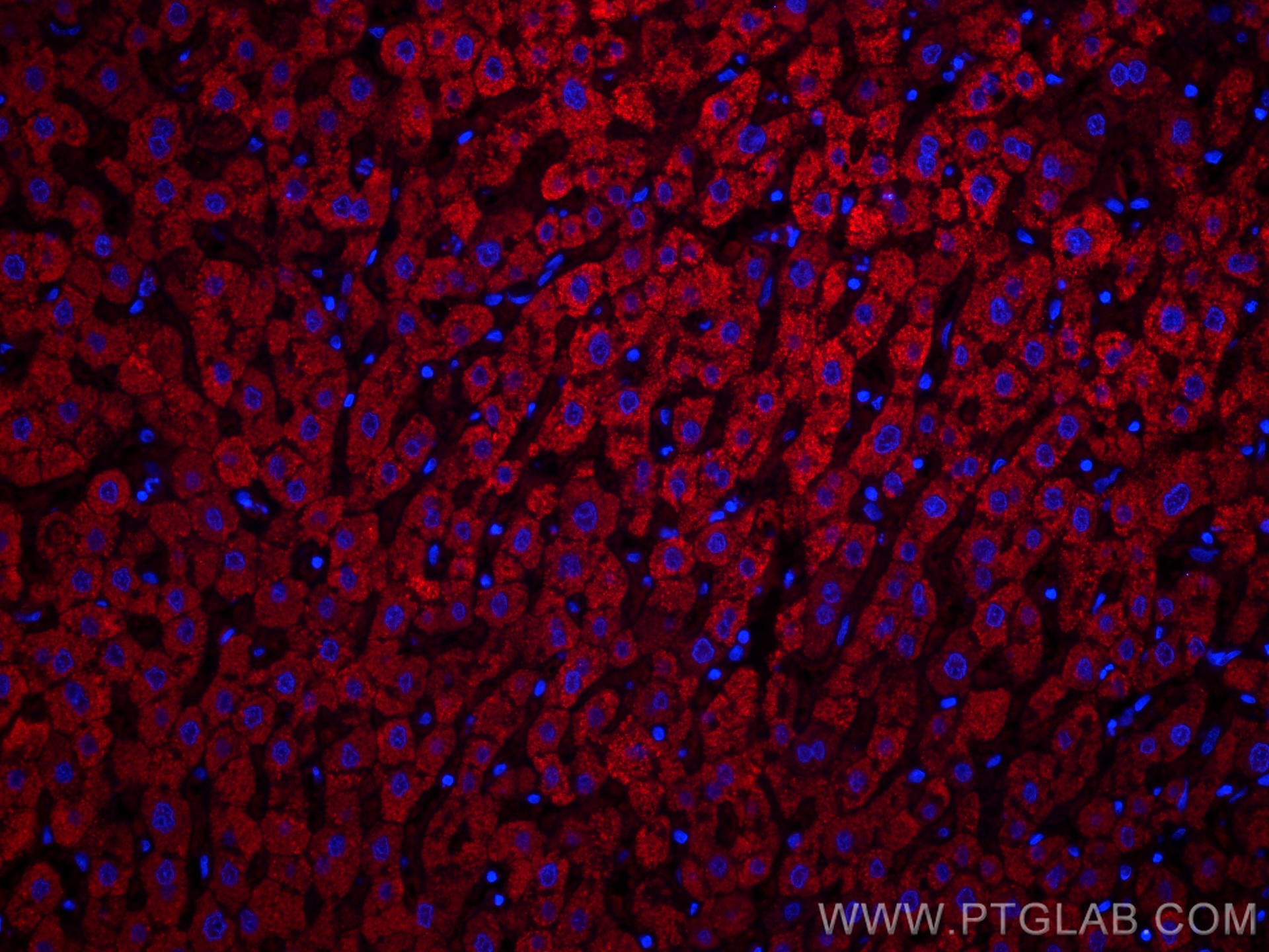 IF Staining of human liver using CL594-66154