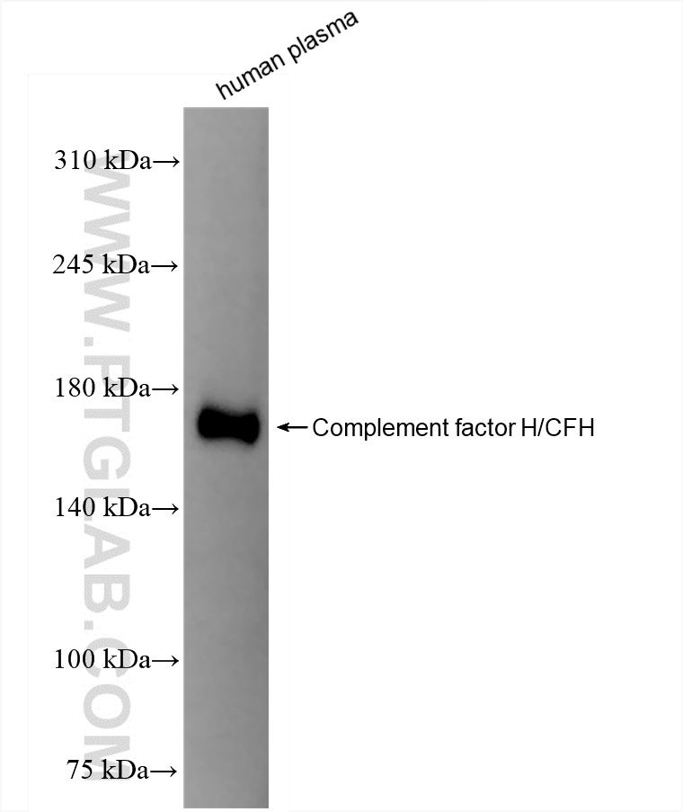 WB analysis of human plasma using 85132-2-RR