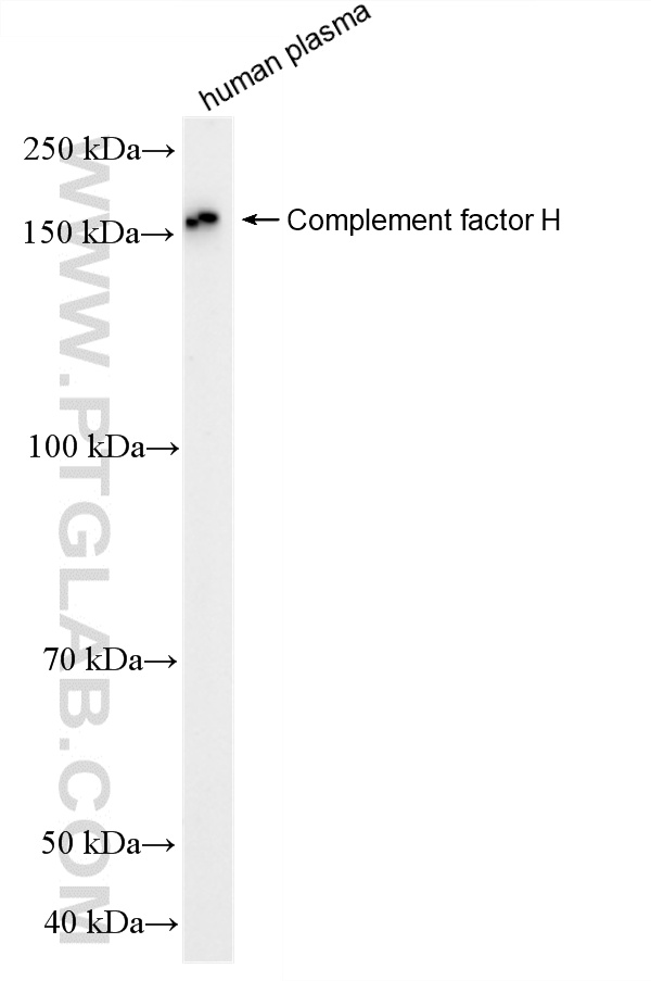 WB analysis of human plasma using HRP-12748 WB analysis of human plasma using HRP-12748