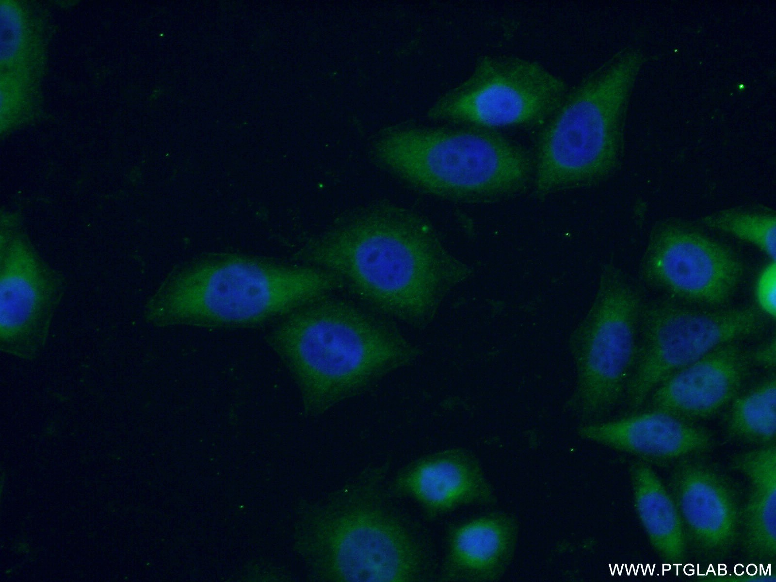 IF Staining of PC-3 using 16960-1-AP