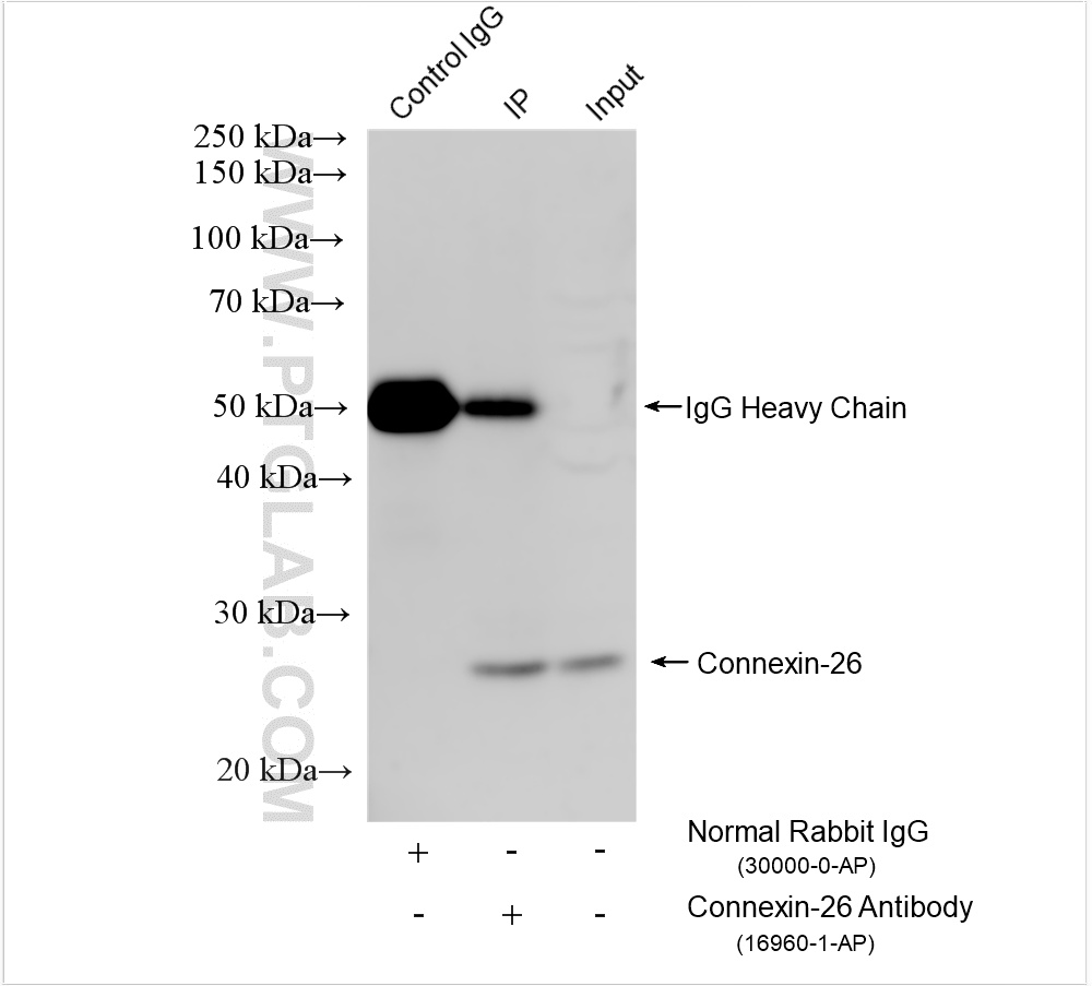IP result of anti-Connexin-26 (IP:16960-1-AP, 4ug; Detection:16960-1-AP 1:3000) with PC-3 cells lysate 1200 ug. IP experiment of PC-3 using 16960-1-AP