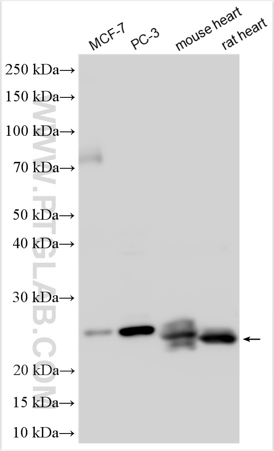 WB analysis using 16960-1-AP