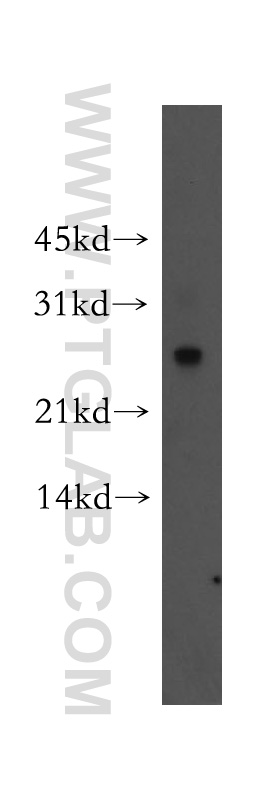 WB analysis of human brain using 51037-2-AP