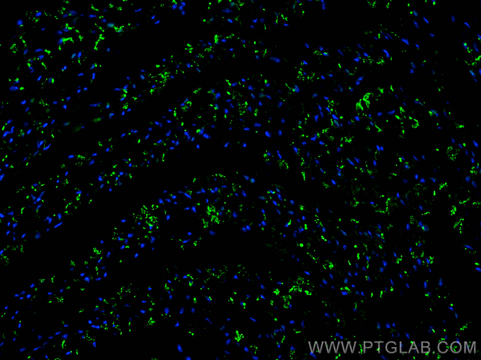 IF Staining of mouse heart using 26980-1-AP