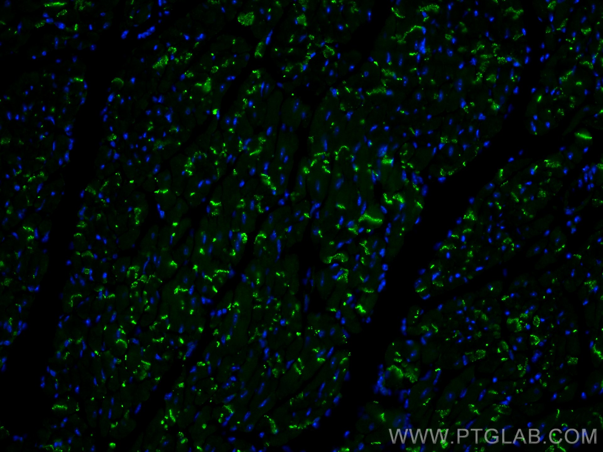 IF Staining of mouse heart using 80543-1-RR (same clone as 80543-1-PBS)