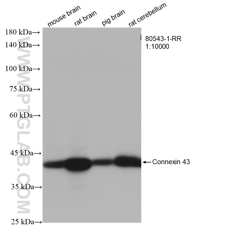 Connexin 43