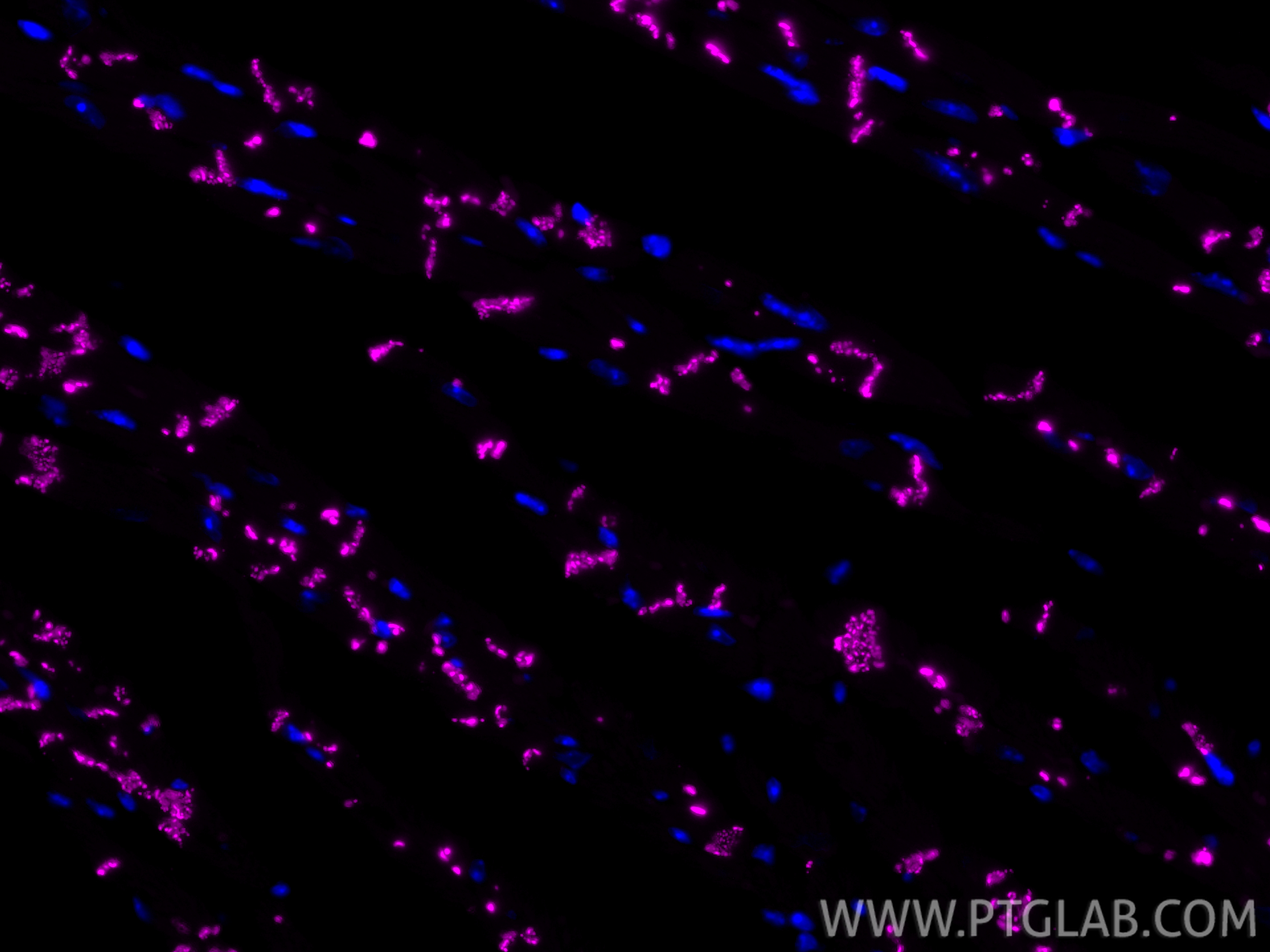 IF Staining of mouse heart using CL647-80543 IF Staining of mouse heart using CL647-80543
