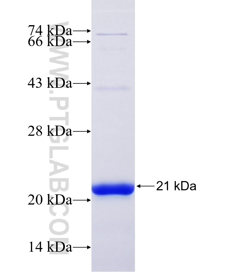 Connexin 43 fusion protein Ag27994 SDS-PAGE Connexin 43 fusion protein Ag27994 SDS-PAGE
