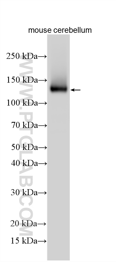 WB analysis using 33731-1-AP (same clone as 33731-1-PBS) WB analysis using 33731-1-AP (same clone as 33731-1-PBS)