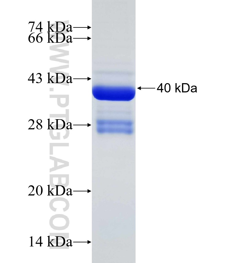 Corticosteroid binding globulin fusion protein Ag31861 SDS-PAGE