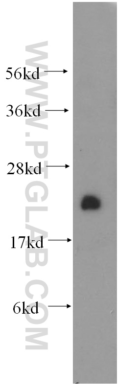 WB analysis of mouse brain using 51102-1-AP