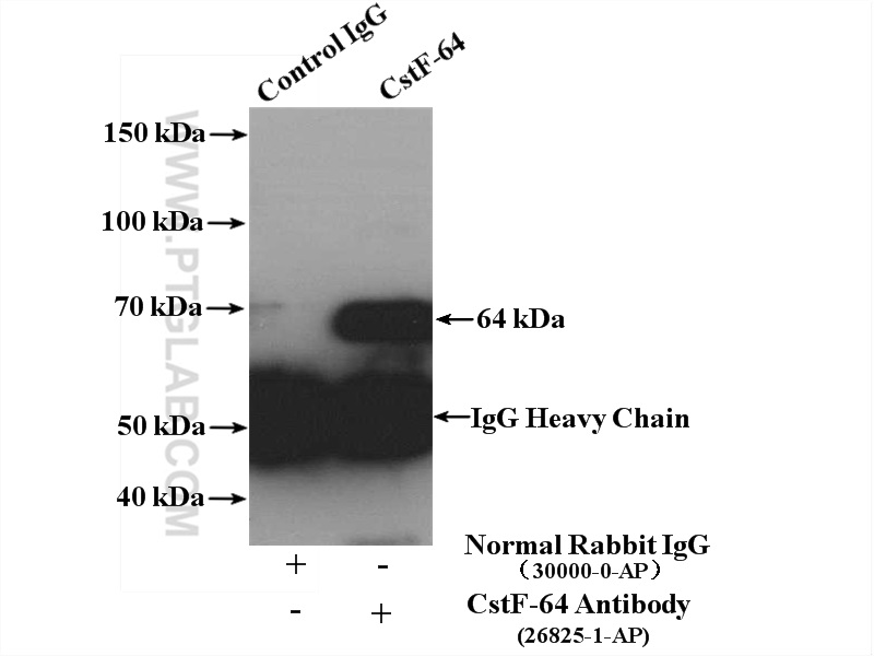 IP experiment of HeLa using 26825-1-AP