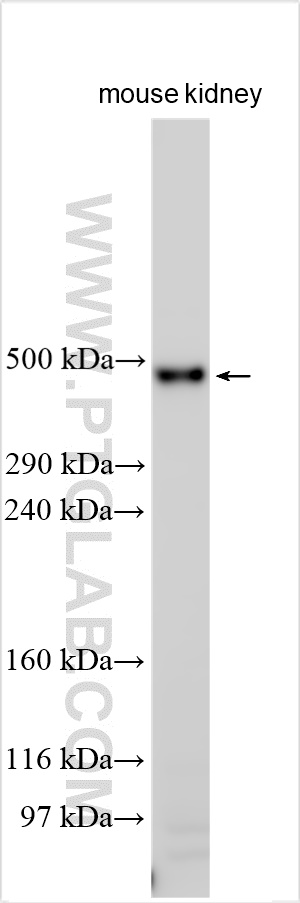 WB analysis using 31992-1-AP