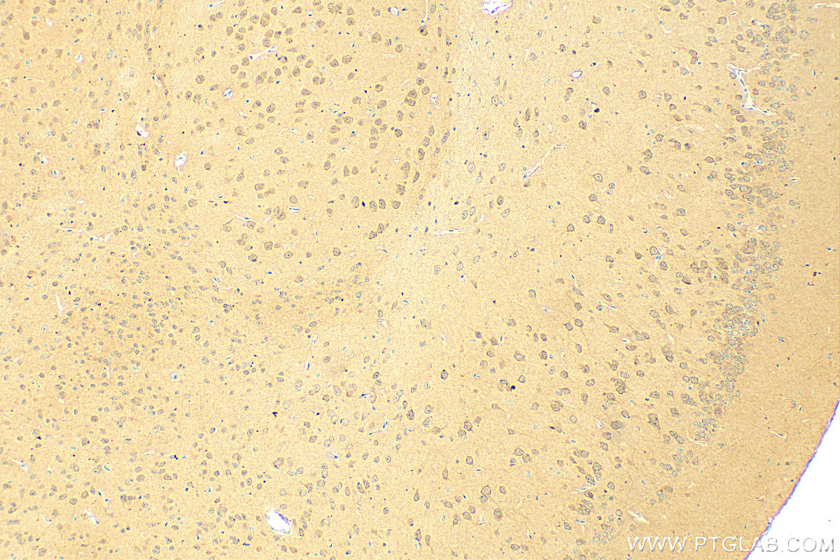 IHC staining of mouse brain using 31183-1-AP (same clone as 31183-1-PBS)