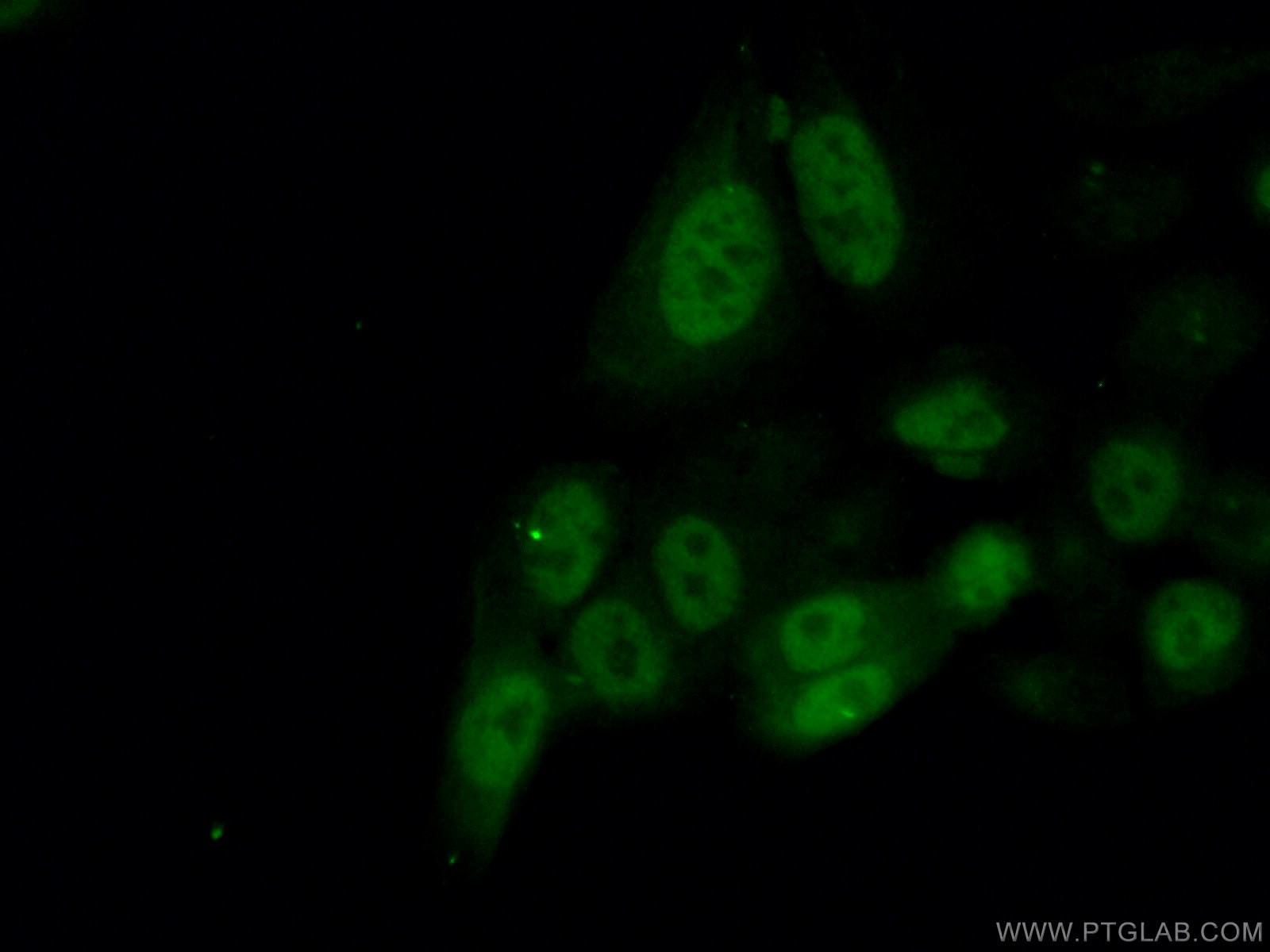 IF Staining of HeLa using 66391-1-Ig