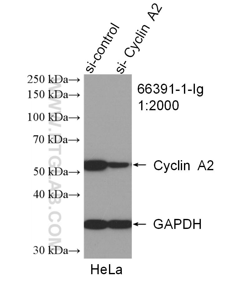 WB analysis of HeLa using 66391-1-Ig