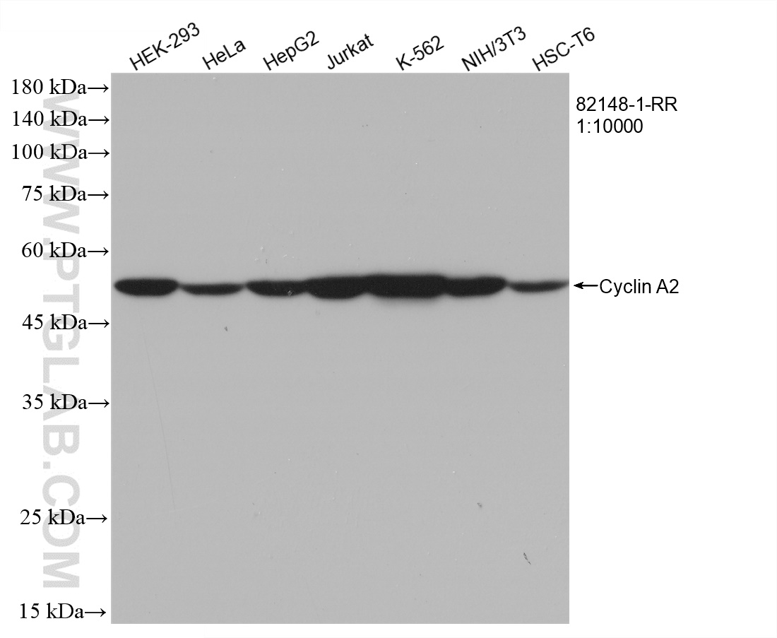 WB analysis using 82148-1-RR