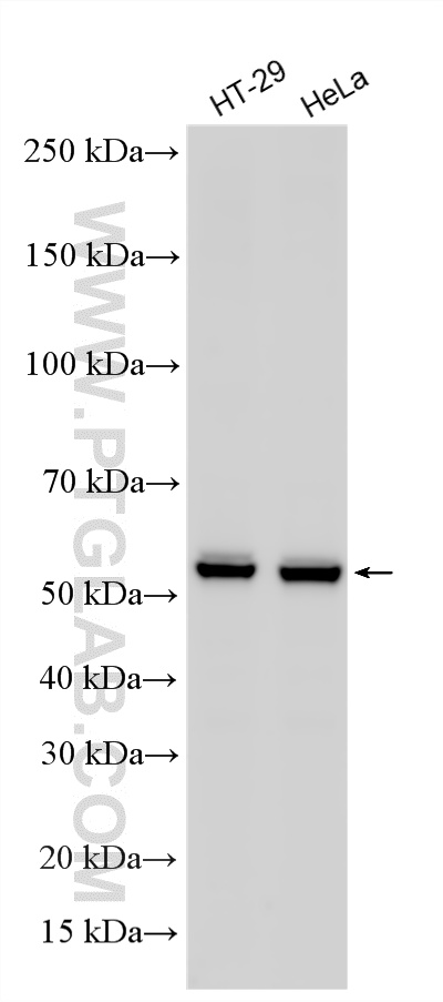 WB analysis using RMX00076 WB analysis using RMX00076