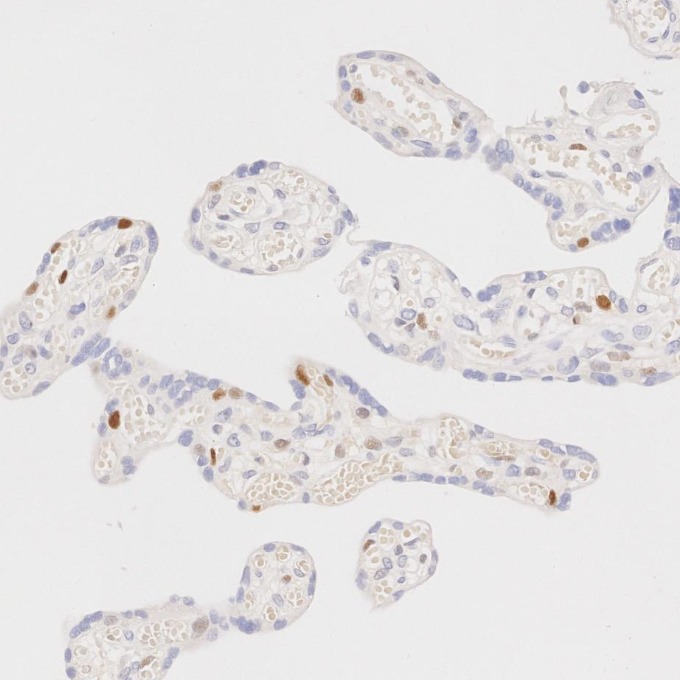 IHC staining of human placenta using 82681-1-RR