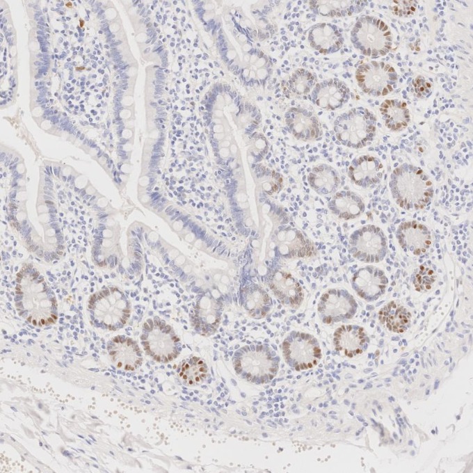 IHC staining of human small intestine using 82681-1-RR