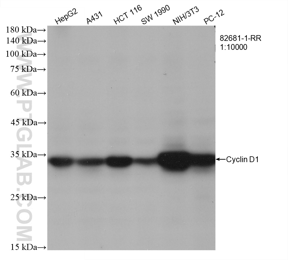 WB analysis using 82681-1-RR