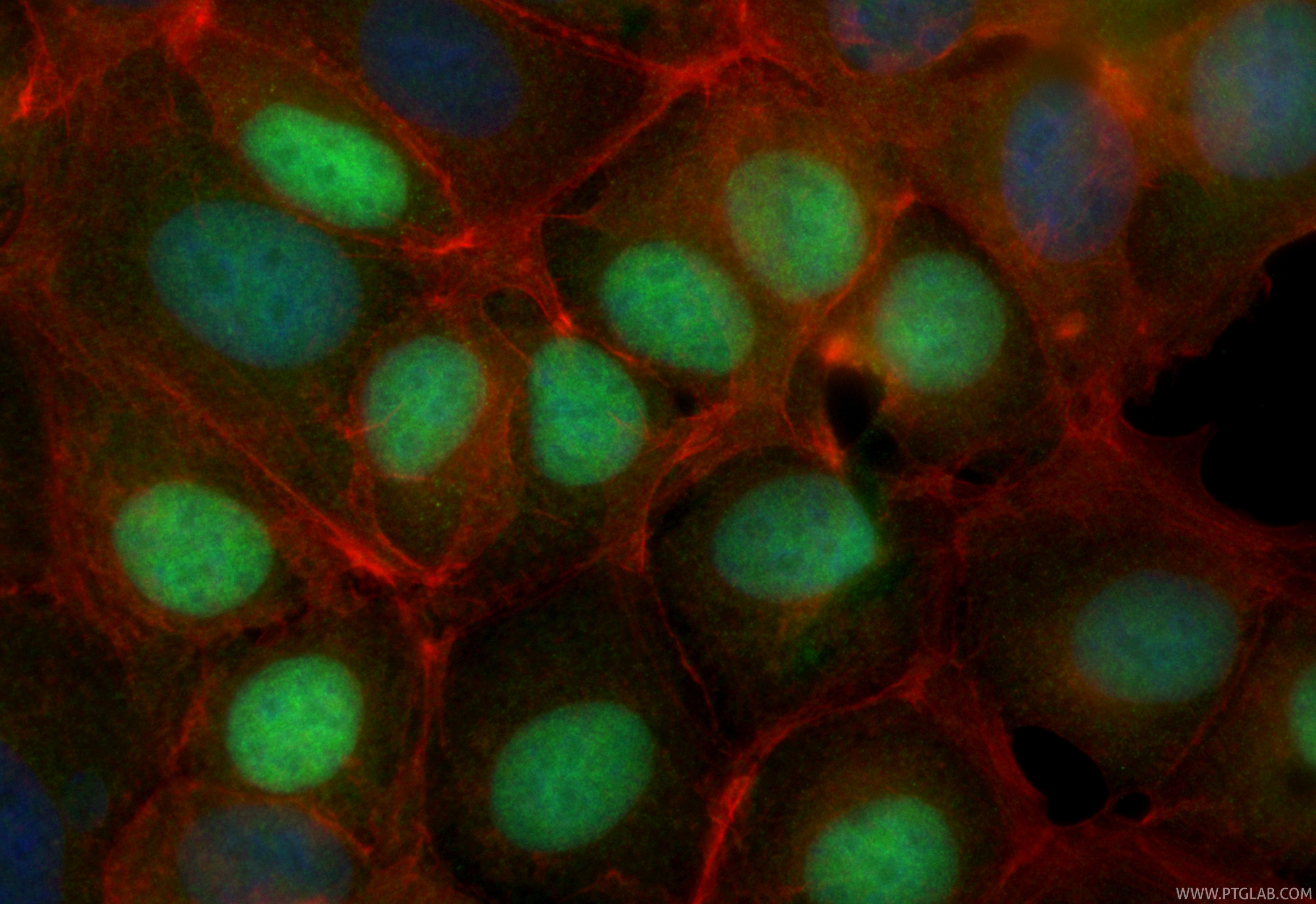 IF Staining of MCF-7 using CL488-82681 IF Staining of MCF-7 using CL488-82681