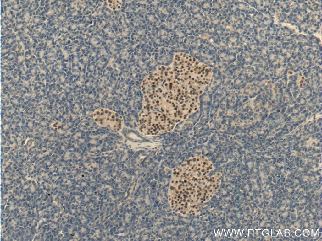 IHC staining of human pancreas using 26755-1-AP