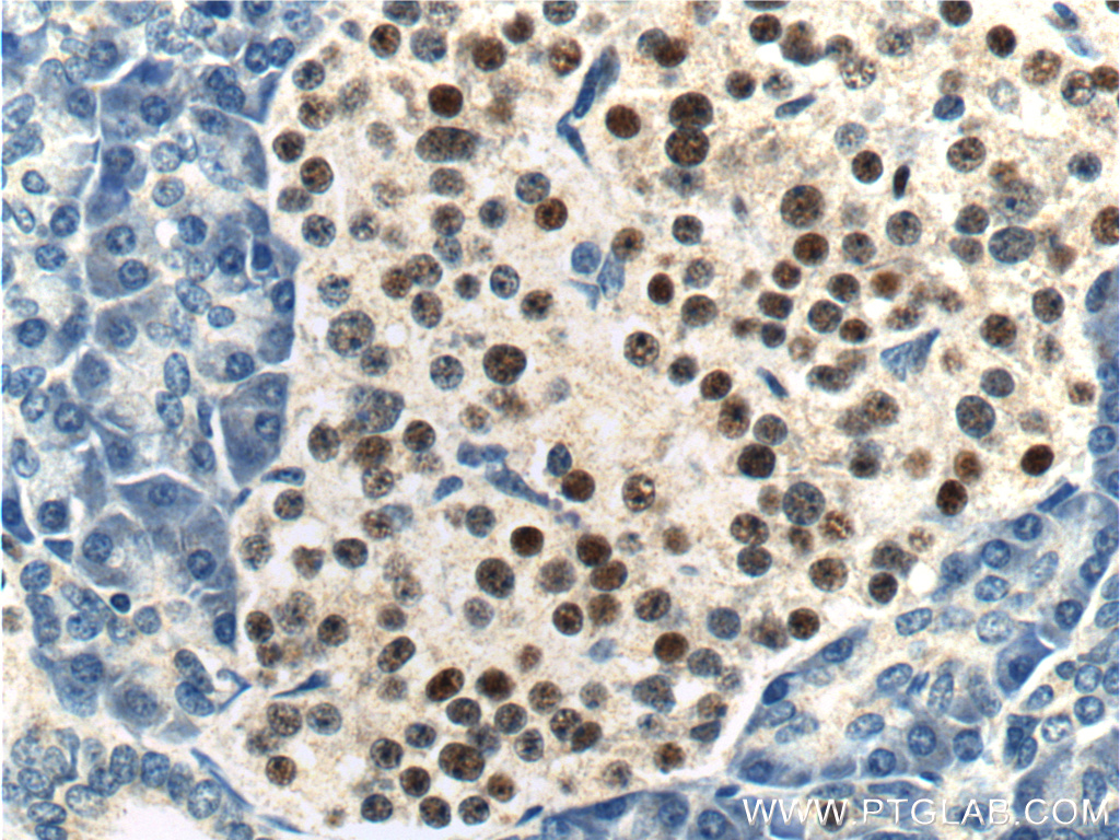 IHC staining of human pancreas using 26755-1-AP