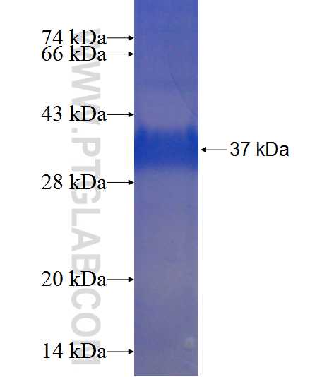 Cyclin D3 fusion protein Ag22825 SDS-PAGE