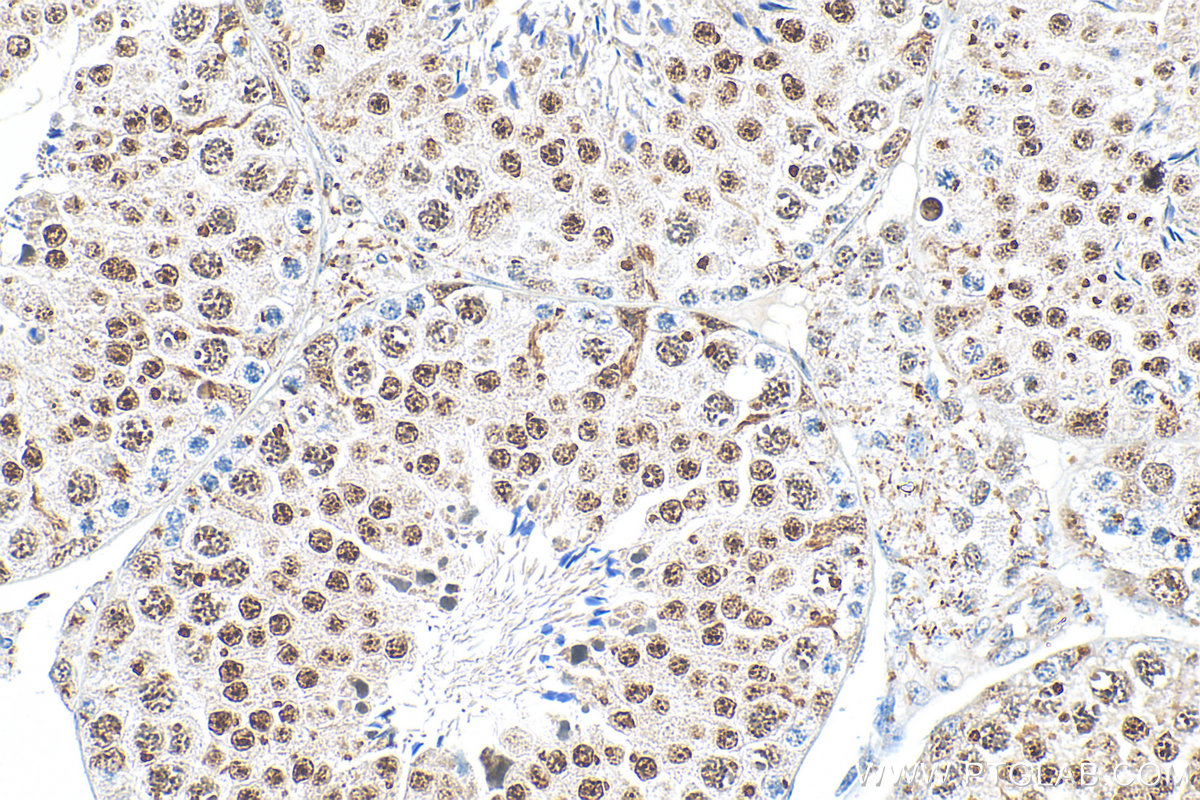 IHC staining of mouse testis using 82700-9-RR (same clone as 82700-9-PBS)