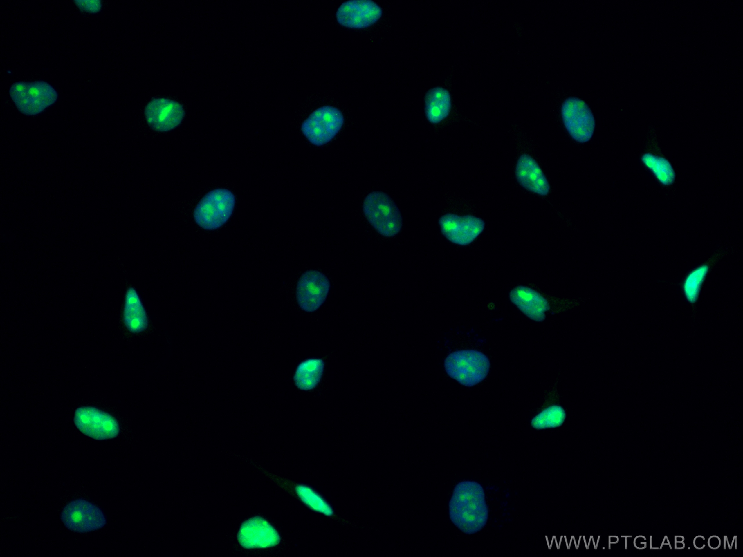 IF Staining of HeLa using CL488-11935